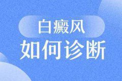 白癜风诊断：汗斑与白癜风之间有哪些区别？