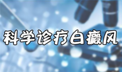 白癜风给患者带来的5方面的伤害？白斑不治危害